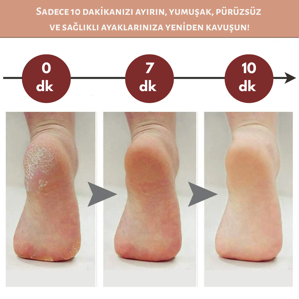 Rosèra SoftStep™ – Pürüzsüz, Yumuşak ve Bakımlı Ayaklar